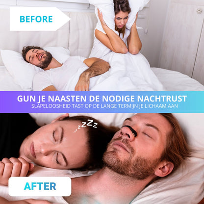 Twenty4seven® Anti Snurk Magnetische Neusclips - 15 Paar - twenty4sevensleep